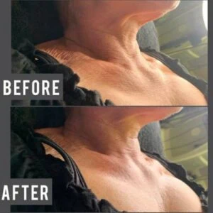 Before and after Gallery