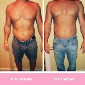 Body Shape treatment Before and After results of man at Petra's Weightloss Clinic Med Spa in Oklahoma City, OK