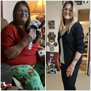 Before and after results of two women showing waist reduction.
