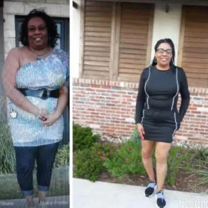 Side view comparison of a woman's hips before and after contouring.