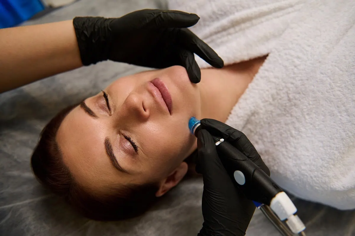A handheld microdermabrasion wand gently pressed against facial skin, with a subtle sparkle of exfoliating crystals visible.