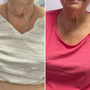 Woman standing in exercise gear before and after weight loss.