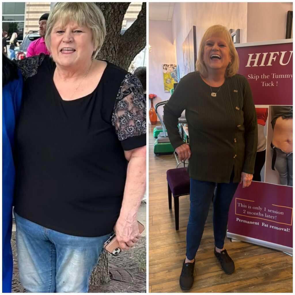 Weight loss program before and after size 24 to size 9 in 5 months