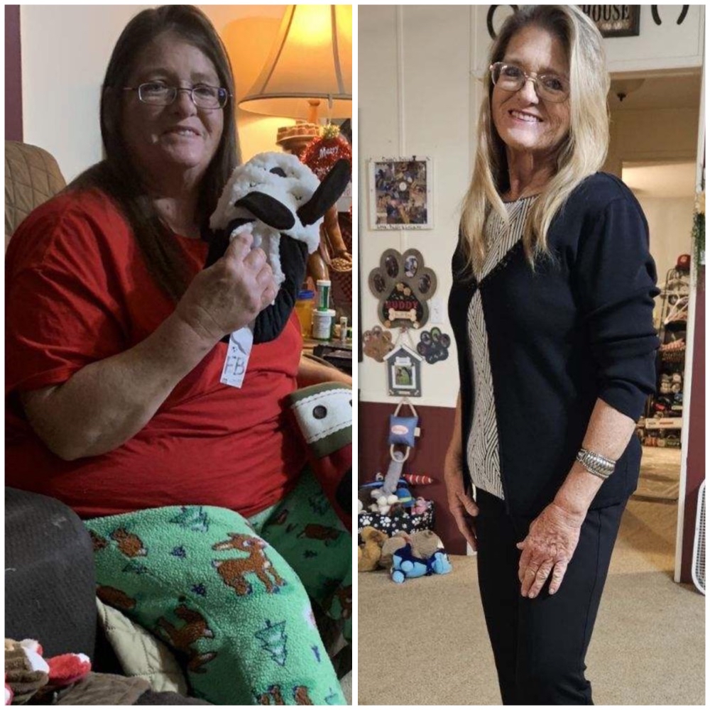 Female weight loss before and after; size 22 to size 4 in 4 months with Petra's Weightloss Clinic in OKC.