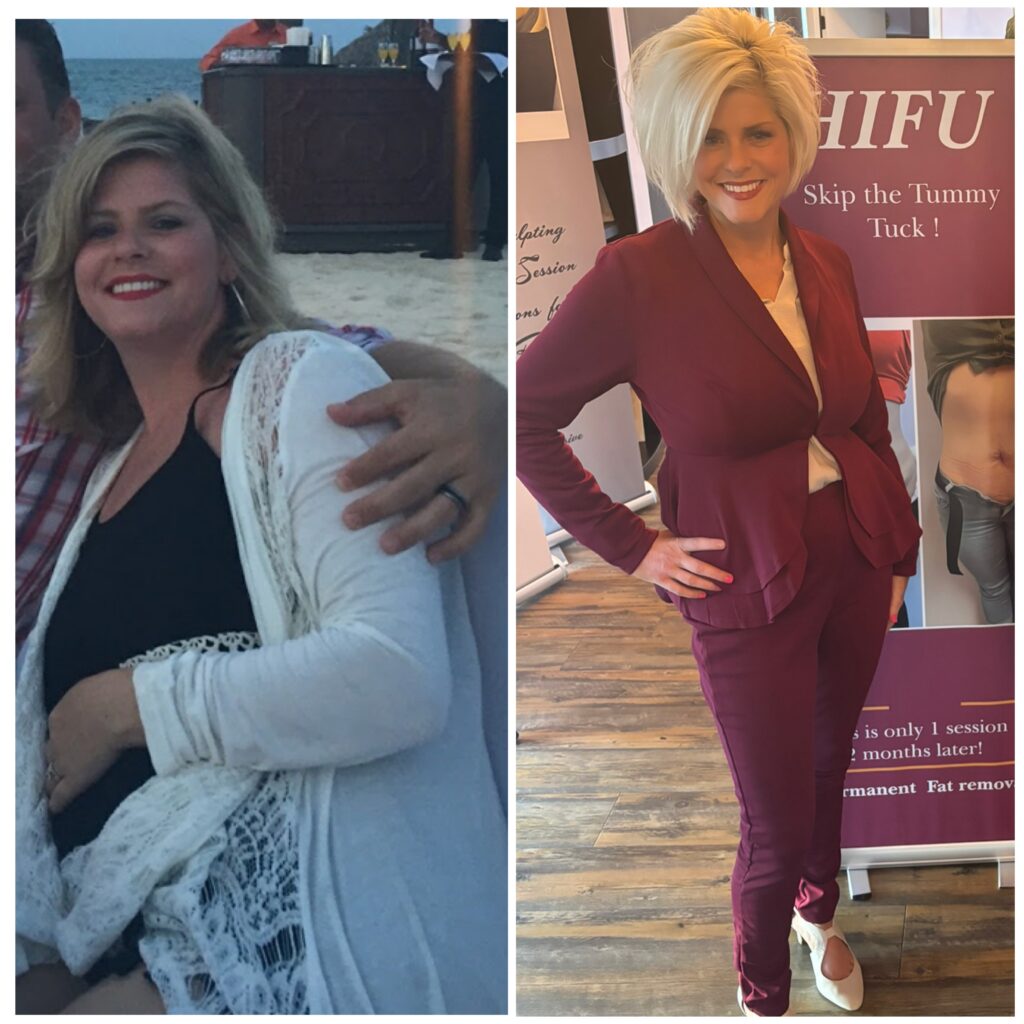 Weight loss program before and after, owner loses 78 pounds and goes from size 18 to size 3 at Petra's Weightloss Clinic.