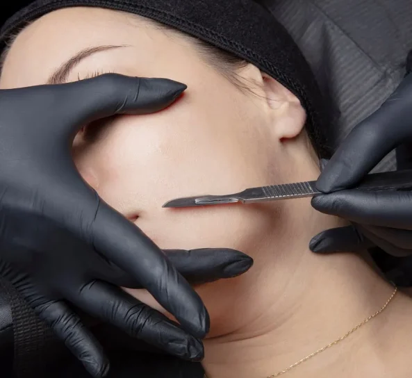 Dermaplaning Treatment Procedure in Oklahoma City, OK