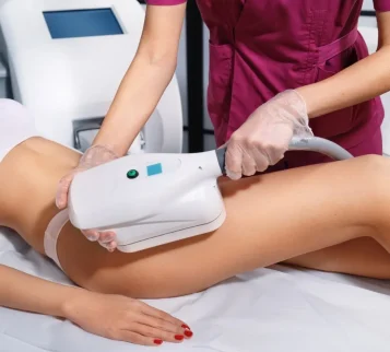 Abstract illustration of a torso with a cooling applicator attached, symbolizing fat‑freezing treatment.