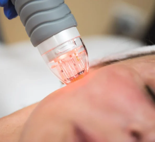 LED and suction facial treatment in Oklahoma City, OK