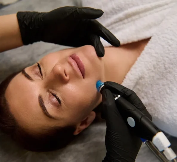 A handheld microdermabrasion wand gently pressed against facial skin, with a subtle sparkle of exfoliating crystals visible.