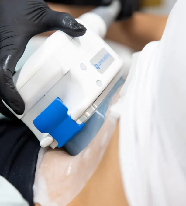 A stylized illustration of the fat‑freezing (cryolipolysis) process, showing a treated body area under a cooling applicator.