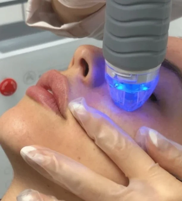 The Hydrafacial device is used on the face in Oklahoma City, OK