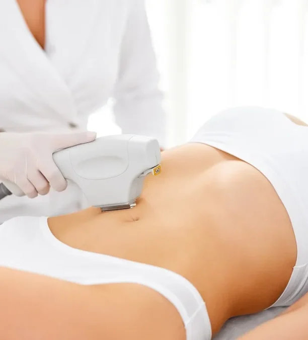 Woman’s abdomen receiving non-surgical fat reduction therapy.