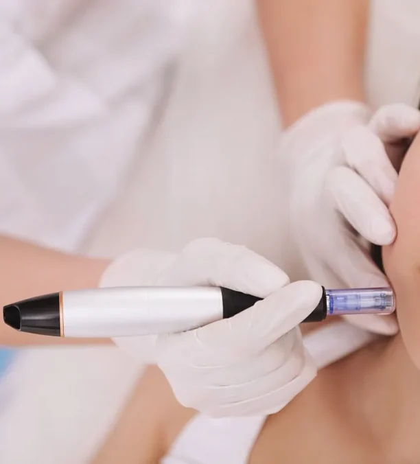 Microneedling device applied to face in Oklahoma City, OK